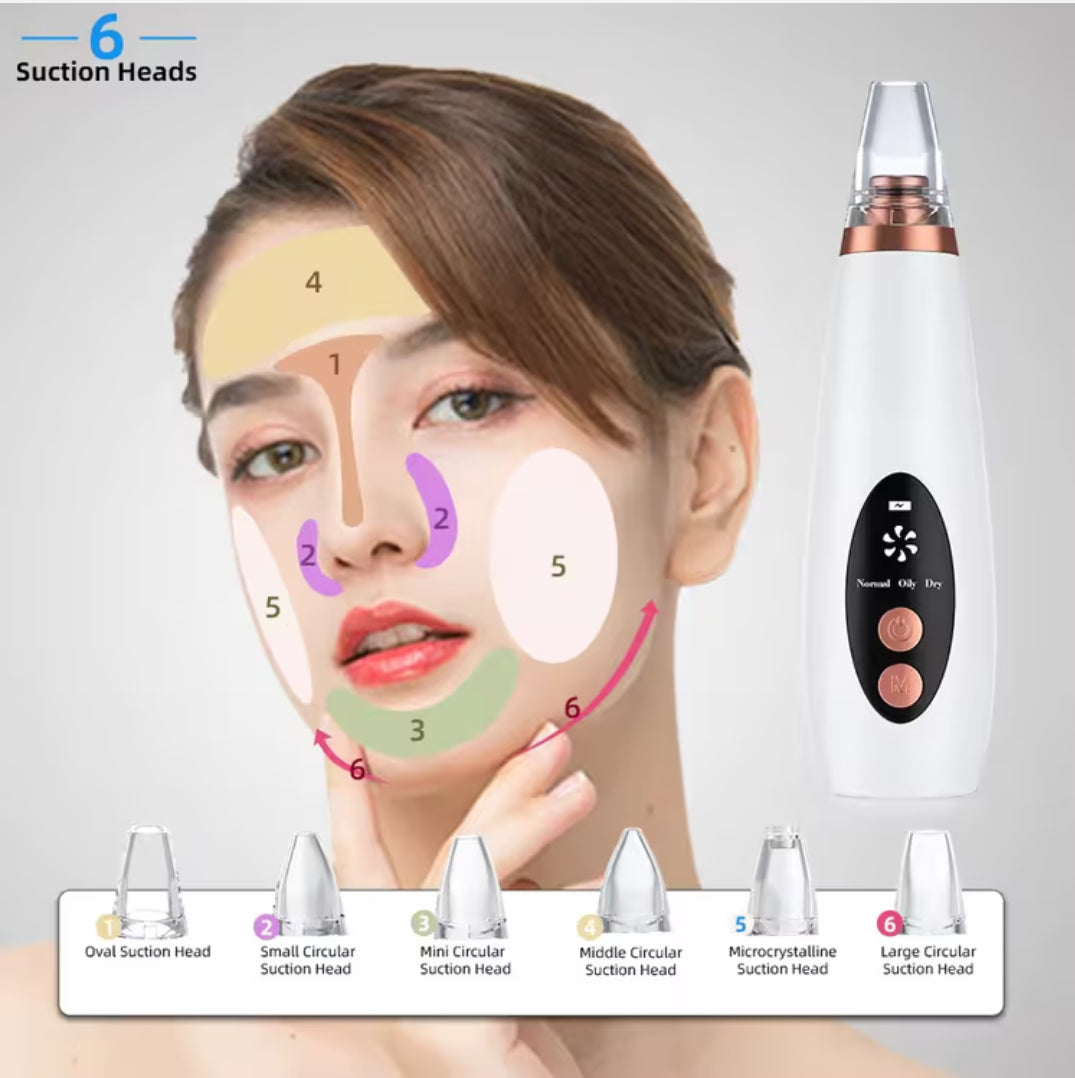 black head remover